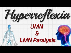 Hyperreflexia