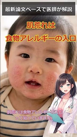 子どもの食物アレルギーは変わり始めている｜医師解説 #医師解説#医学#麻酔科医#食物アレルギー#アレルギー