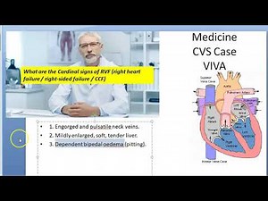 Medicine 9913 CVS Case Discussion CardioVascular System Viva Questions History Practical Heart