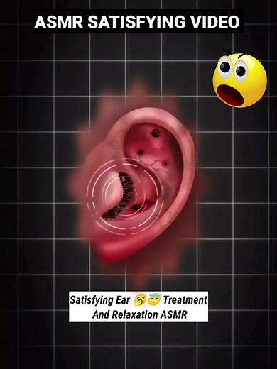 Relax Every Day With Sac Dep Spa | 70 | #acne #blackheads #whiteheads #Treatments #pimple