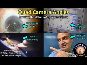 CataractCoach 1098: quad camera angles to learn cataract surgery