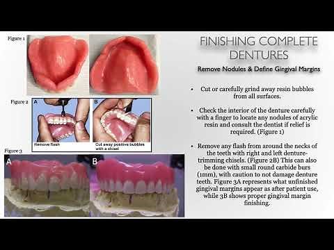 Complete Denture Recovery/Finishing & Polishing - Lecture
