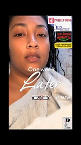 ❗️𝐒𝐀𝐓𝐈𝐒𝐅𝐈𝐄𝐃 𝐂𝐔𝐒𝐓𝐎𝐌𝐄𝐑❗️ 𝐏𝐮𝐫𝐞𝐬𝐬 𝐒𝐤𝐢𝐧 𝐋𝐢𝐠𝐡𝐭𝐞𝐧𝐢𝐧𝐠 & 𝐁𝐫𝐢𝐠𝐡𝐭𝐞𝐧𝐢𝐧𝐠 𝐏𝐫𝐨𝐝𝐮𝐜𝐭𝐬 🌳 𝐕𝐄𝐆𝐀𝐍 & 𝐎𝐑𝐆𝐀𝐍𝐈𝐂 🌳 0% ℬℒℰ𝒜𝒞ℋ 🔥 SATISFIED CUSTOMER 🔥 ❗️Visible results in just 1-4 weeks depending on the discoloration(s)❗️ Puress’s products do work!. We satisfy 100’s of Clients on a weekly basis. Get yourself our organic Skin Lightening & Brightening Soap and Cream today and experience a change. 🤝♥️ Puress products are 𝐕𝐈𝐑𝐀𝐋 and 𝐁𝐄𝐒𝐓 𝐒𝐄𝐋�