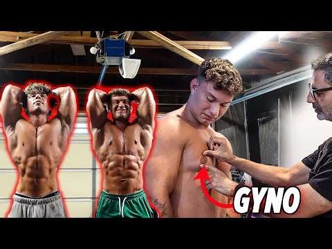 I GOT GYNO SURGERY WITH LEXX LITTLE