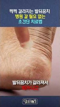 피가 날 정도로 갈라지고 아픈 발뒤꿈치😥 병원 가지 않고 집에서 쉽게 치료하는 방법⭐