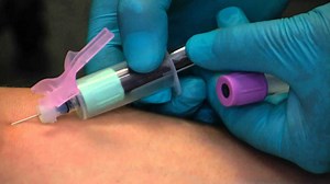 Venipuncture procedure, venipuncture sites, veins & venipuncture complications