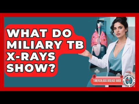 What Do Miliary TB X-rays Show? - Tuberculosis Disease Guide