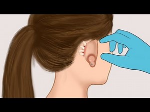 Satisfying ASMR | Remove Maggots from Infected Ear Piercing Animation