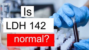 Is LDH 142 normal, high or low? What does Lactate dehydrogenase level 142 mean?