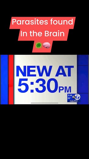 Researchers have found through brain autopsies that parasites in the brain are the cause of MS 🦠•These are the top ten ways to know if you have parasites in your body. 1. Digestive Issues: Diarrhea, constipation, gas, or bloating.2. Abdominal Pain: Cramps or discomfort in the stomach area.3. Unexplained Weight Loss: Losing weight without trying.4. Fatigue and Weakness: Persistent tiredness and lack of energy.5.Skin Problems: Rashes, itching, or sores.6. Anemia: Iron deficiency or low red blood 
