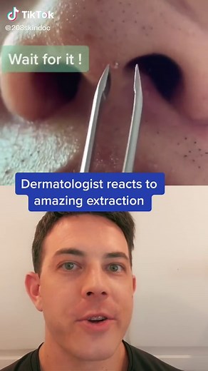 Professional Blackhead Extraction by Dermatologist