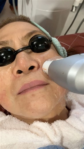 5 benefits of Ultraformer Hifu Assists with facial contouring Encourages skin tightening Stimulates collagen Softens fine lines Non invasive Visit Sakira Lash • Spa & Aesthetics | Gellie Mie Basibasi Bajao | Facebook