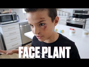 IT COULD HAVE BEEN SO MUCH WORSE | FALLING FACE FIRST ONTO THE PAVEMENT | PAINFUL FACEPLANT