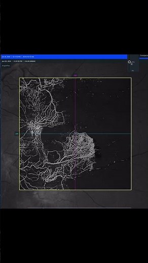 Amazing visualization of neovascularization by Angioplex VRI segmentation in a case of proliferative