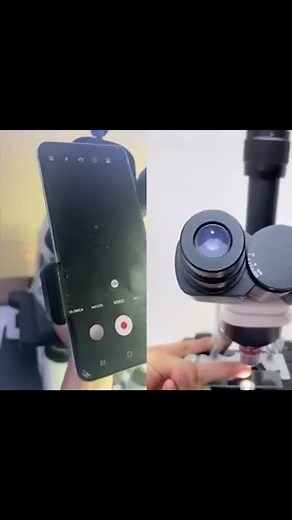 👉 FINGER UNDER THE MICROSCOPE 🔬