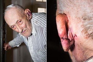 Teen charged with attacking elderly man with a cane