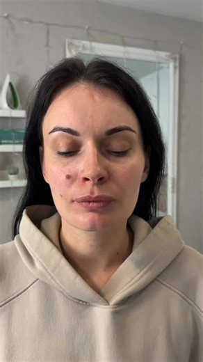 Special: Buccal Facial Massage Facial Mask 50 min ✨ This unique intraoral technique works on the deep facial muscles from the inside — where other massages can’t reach. It helps soften the heavy lower face, release inner tension and even reduces nasolabial folds by relaxing the deep muscles around the mouth. Buccal massage also improves circulation and supports your skin’s natural collagen — making your face look firmer, brighter and naturally lifted. A powerful treatment for anyone who wants a 