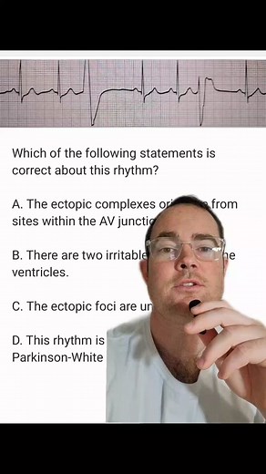 Understanding EKG Rhythms: Identifying Irregular Beats