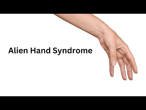 Alien Hand Syndrome