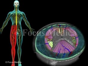 Brown sequard syndrome - Back and Spinal Cord