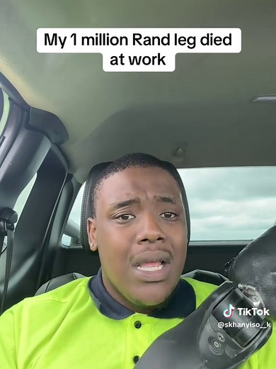 Struggles of Living with a 1 Million Rand Artificial Leg