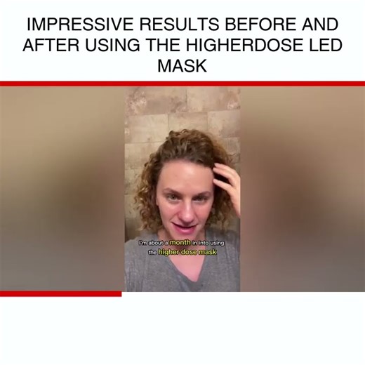 Impressive results before and after using the higherDose LED mask