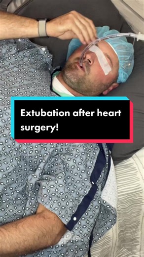 This is one of the most common questions that I get when I am interviewing my patients before their heart surgery. #anesthesia #anesthesiologist #physician #drjamo #heartsurgery #OR #intubation #extubation #questions #answers #anesthesialife