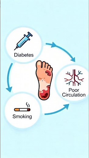 Gangrene: The Silent Killer You Didn't Know Existed