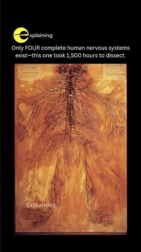 One of the Rarest Anatomical Specimens on Earth