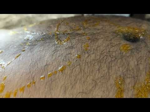 "ASMR Belly Button Massage | Sleepy Oil Drips & Gentle Strokes"