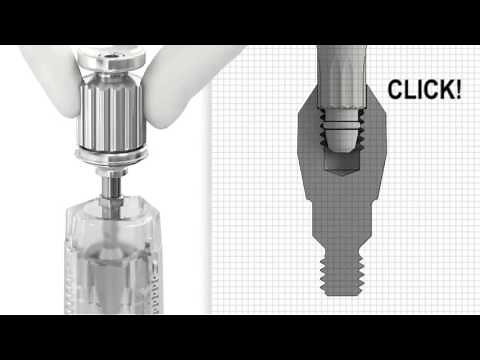 UniAbutment EV - Installation | Dentsply Sirona