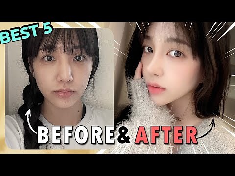 5 AMAZING Korean Plastic Surgery Transformation |Dramatic Makeover Before and After Results in Korea