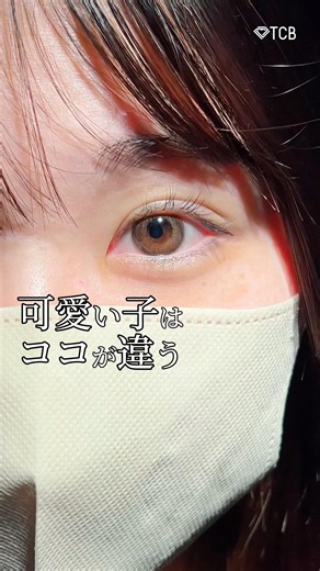 [Double Eyelid Surgery] There's a Secret to Being Cute #shorts