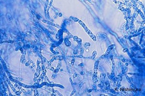 Pythium insidiosum - Alchetron, The Free Social Encyclopedia