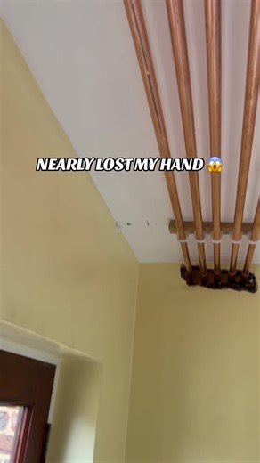 Nearly Lost My Hand: A Shocking Electrician Story
