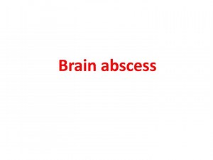 Brain abscess - SlideServe