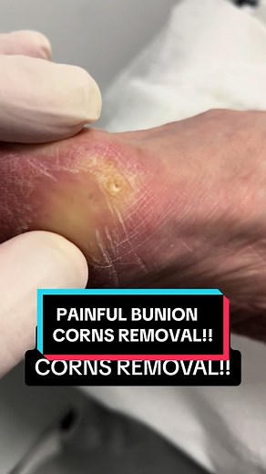 The Foot Doctor on TikTok