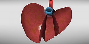 Segment I/IV mesoheptectomy - TVASurg - The Toronto Video Atlas of Surgery
