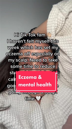 Managing Eczema Flare-Ups: The Connection to Mental Health and Stress Levels