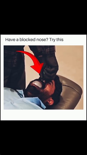 Doctor Unblocks Nose in Seconds Using a Balloon! 😳 | How It Works#shorts