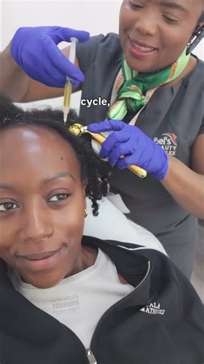 PRP Treatment for Hair Loss: Does It Really Work?