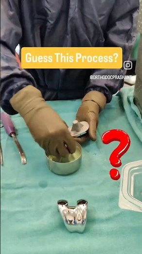 Bone Cementing for Knee Replacement Surgery #Bonecement #jointreplacement #nursingeducation