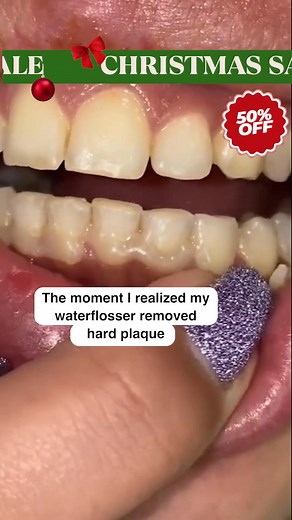 🎃 We Found the Best HALLOWEEN SALE 🎃 55% OFF on Top-Rated Pick Plus FREE 4 Gifts. We Spent the Last Three Months Testing the 24 Water Flossers Devices to Find the Best 5 Water Flossers in 2025. We rated the best five options based on👇 ✅ Best Results ✅ Safe for At-Home Use ✅ Cost Effective ✅ 100% Money Back | Water Flosser