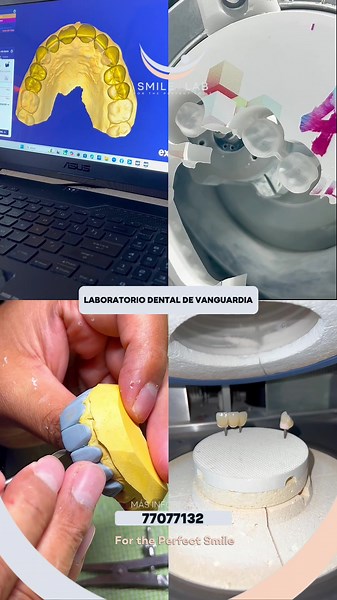 Smile Lab - Laboratorio Dental de Vanguardia