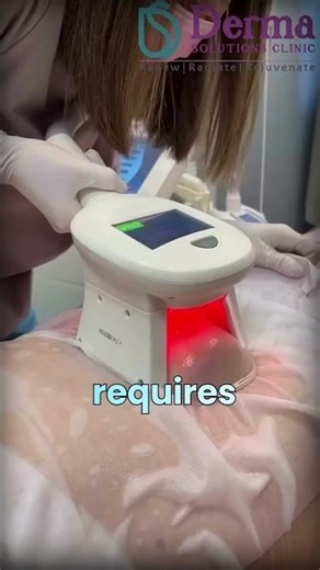 CoolSculpting or Liposuction? Here’s What You Need to Know