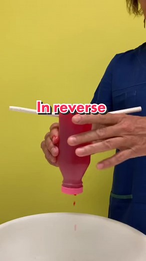 Understanding Retrograde Menstruation: How Does Period Blood Transfer in Your Body?