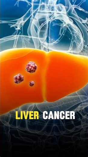 Silent Signs of Liver Cancer: Why Early Detection Matters