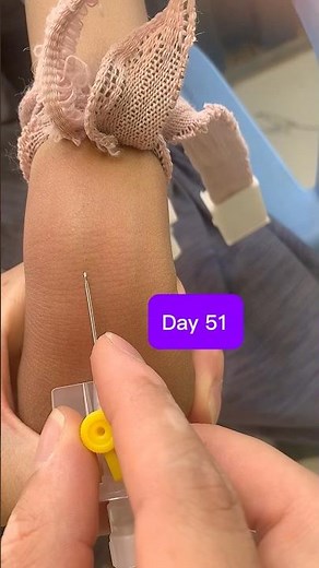How to Insert a 24G Yellow IV Cannula Perfectly Every Time! | Day 51 Clinical Skills#safi #shorts