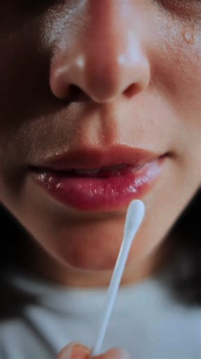 Si te cuidas los labios, te los hidratas cada día y aun así sigues con grietas, puede deberse a algo más que sequedad. En el vídeo te contamos las causas más frecuentes, como la queilitis, la dermatitis irritativa o las infecciones por hongos. Si notas que empeora, te sangran, o incluso aparece una heridita en la comisura, es momento de visitar a tu dermatólogo para un diagnóstico profesional y un tratamiento adecuado. Tu piel te está avisando. 💙 📍 Dermagades · Calle La Angelita nº1, local 20 