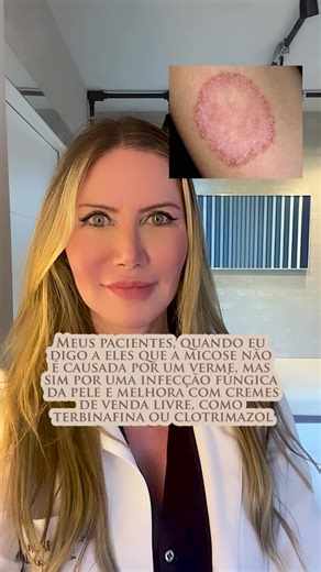 Micose: Sintomas, Tipos e Tratamentos